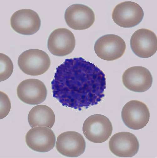 Pattern recognition classification of cells