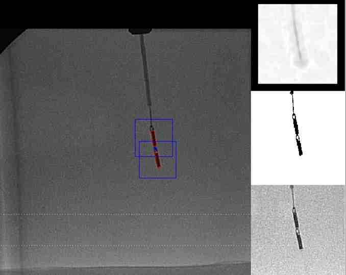 Catheter measurement in angiography