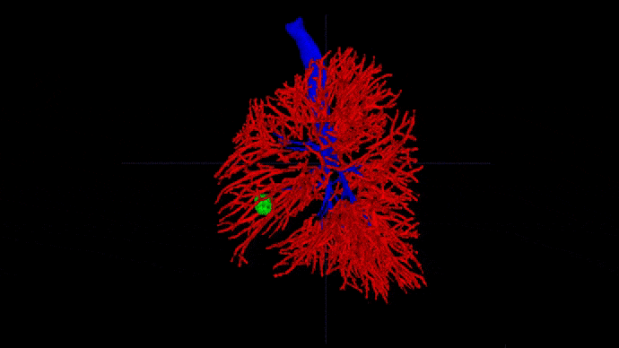 Automated lung segmentation - airways and blood vessels