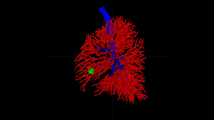 Pulmonology and Bronchoscopy