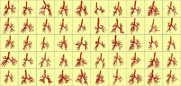 Airways segmentation