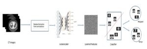 Lung nodules classification