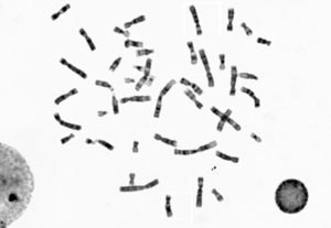 Karyotype