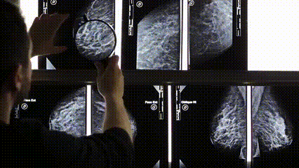 Mammography X-Ray manual check