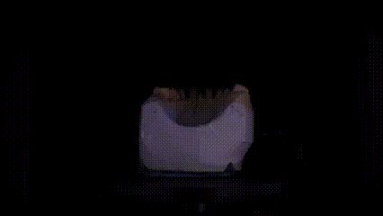 Dental 3D scanner