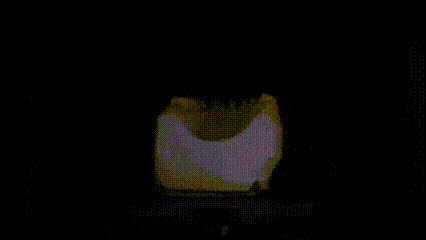 Dental 3D scanner