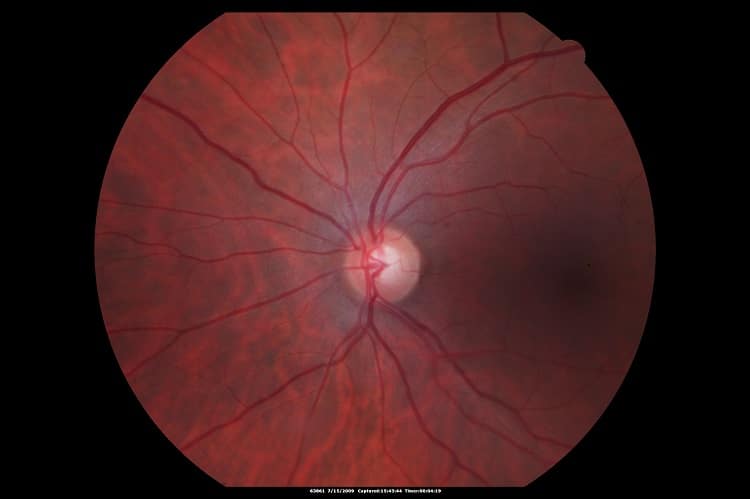 Fundus image