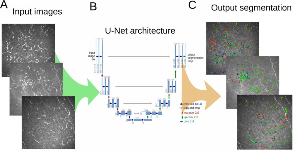 Classification and Segmentation of Dendritic cells