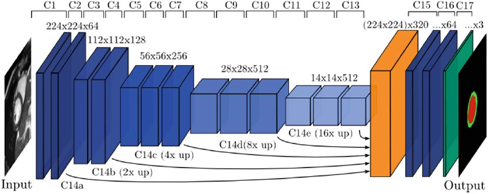 Cardiac Motion Correction