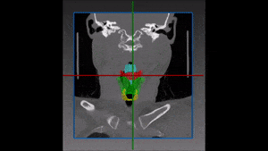 Larynx