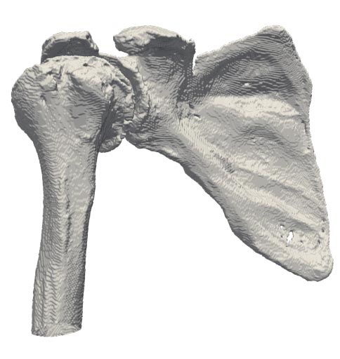 Shoulder Segmentation