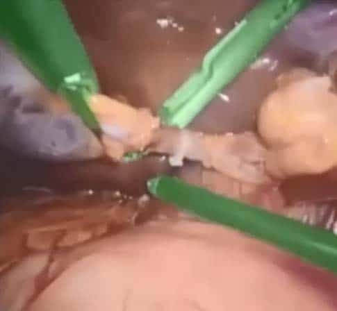 Endoscopy - Instrument Segmentation