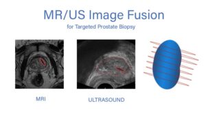 Urology image fusion