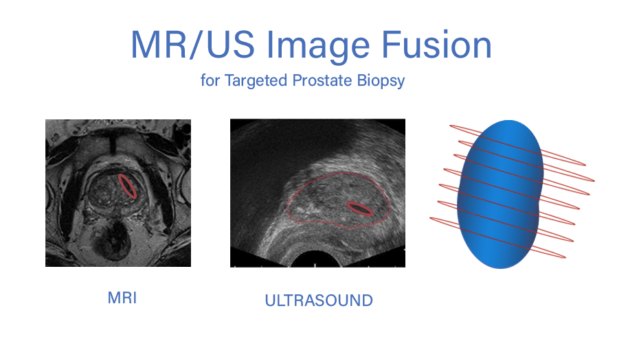 Urology image fusion