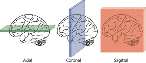 Image from https://users.fmrib.ox.ac.uk/~stuart/thesis/chapter_3/section3_2.html