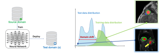 Chen Chen - domain shift problem 