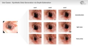 Data Generation in Robotic Assisted Surgeries (RAS)