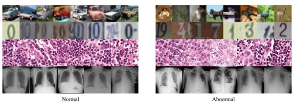 Review Of Anomaly Detection In Medical Imaging Paper Review Of Anomaly Detection In Medical Imaging Paper