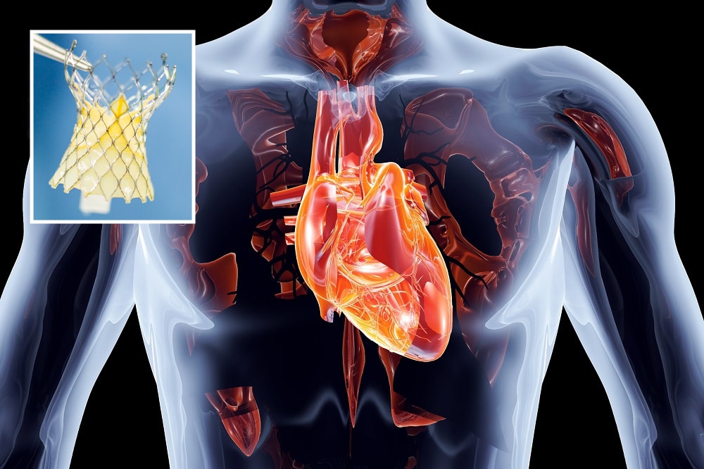 Human Heart 3d with Valve