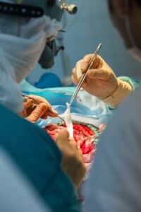 Soft Tissues Tracking during Brain Surgery