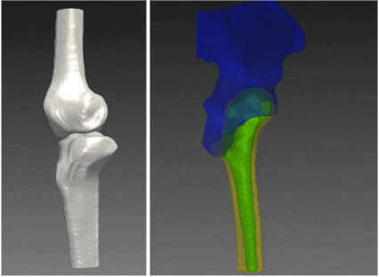 2D-to-3D joint reconstruction from X-ray