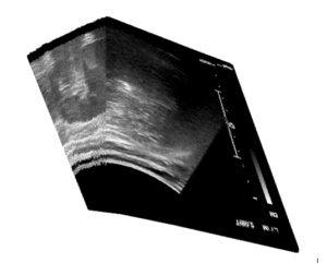 3D volume generation using ultrasound images and tracking information